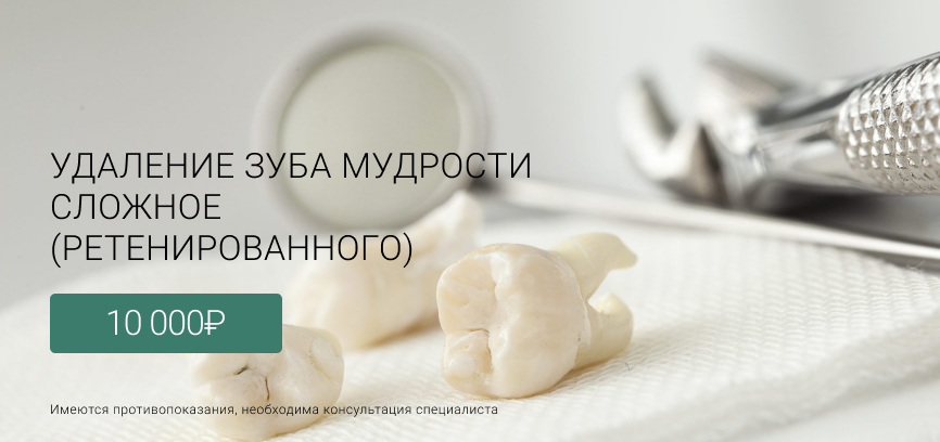 Удаление зуба мудрости сложное (ретенированного) Маршала Казакова 72