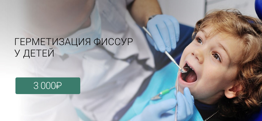 Герметизация фиссур у детей Маршала Казакова 72