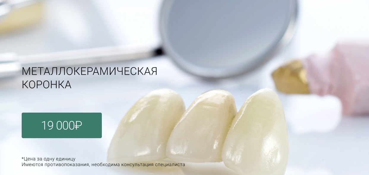 Металлокерамическая коронка Маршала Казакова 72